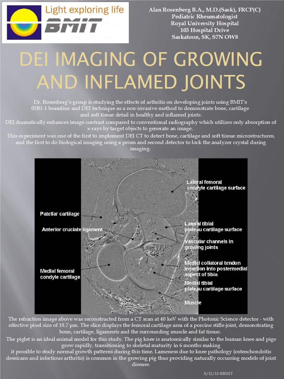 DEI Imaging of Growing and Inflamed Joints Image