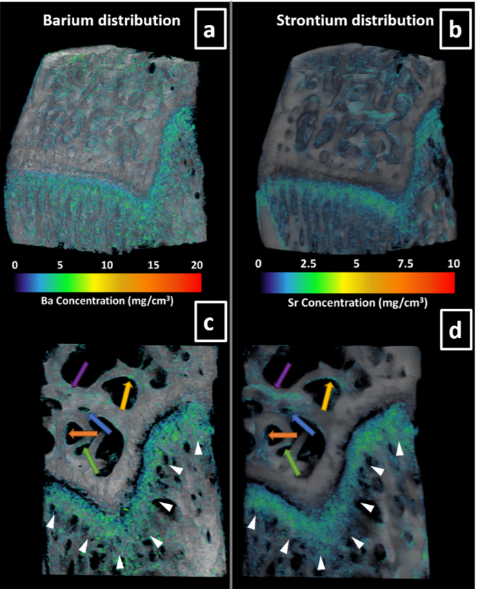 K-edge Subtraction Imaging of Barium and Strontium in Bone Image