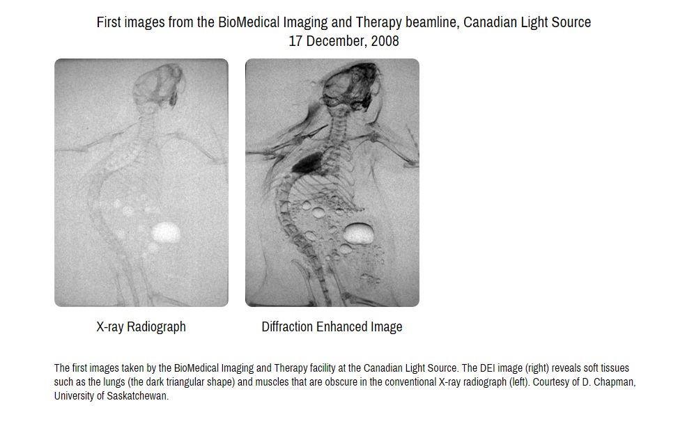 FIRST IMAGES FROM MEDICAL BEAMLINE AT CANADIAN LIGHT SOURCE Image