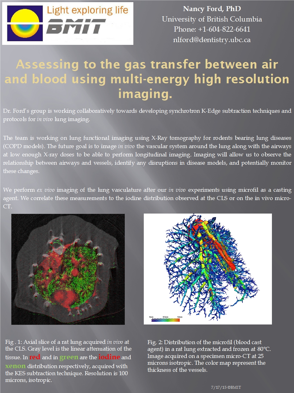 Assessing the Gas Transfer between Air and Blood Using Multi-Energy High Resolution Imaging Image