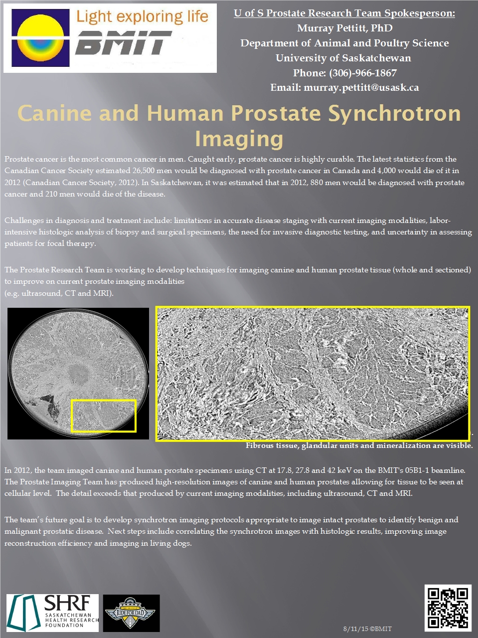 Canine and Human Prostate Synchrotron Imaging  Image