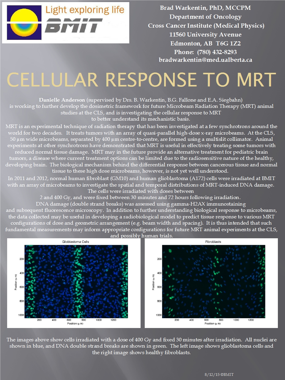 Cellular Response to Microbeam Radiation Therapy (MRT) Image
