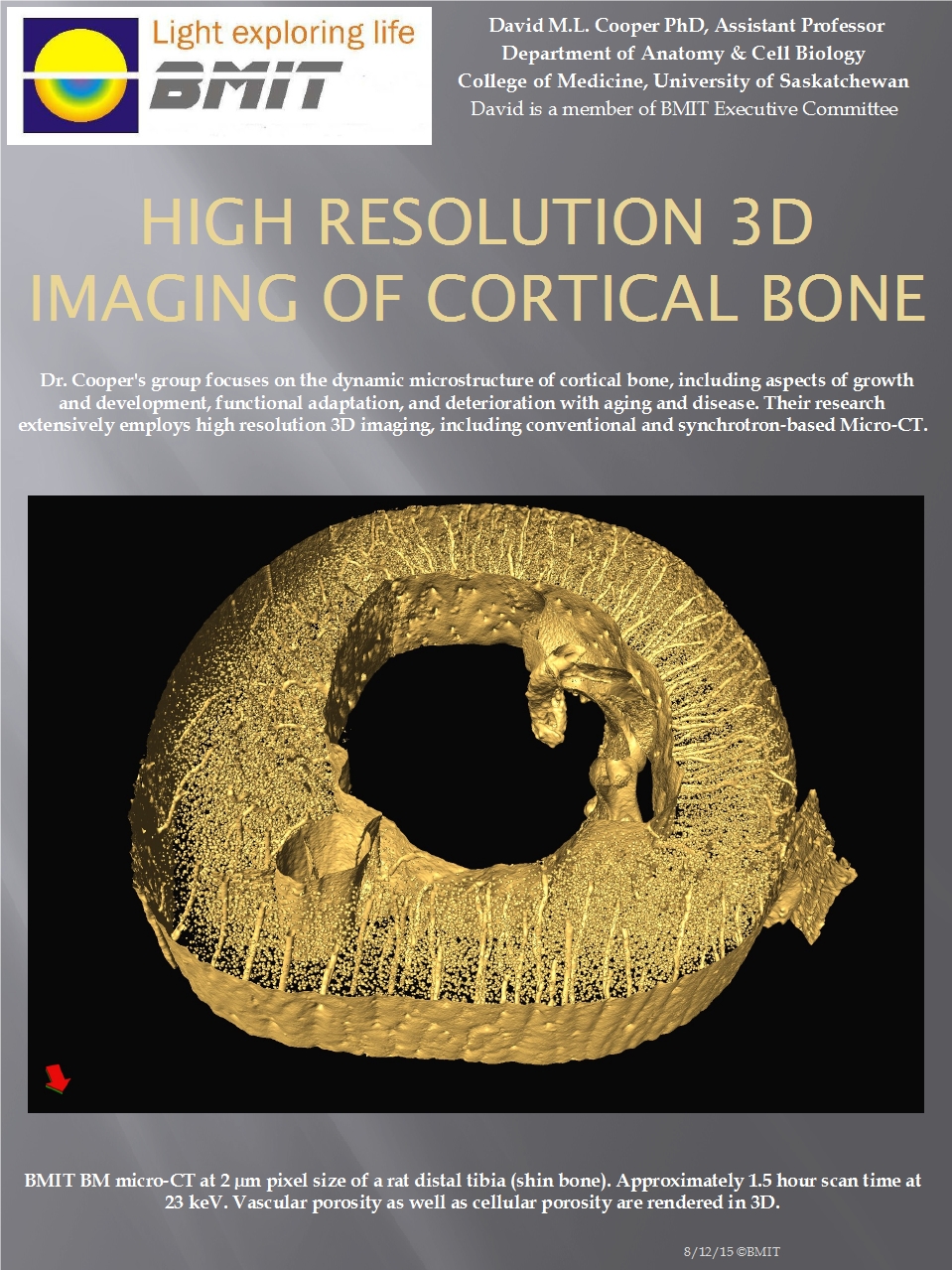 High Resolution 3D Imaging of Cortical Bone Image