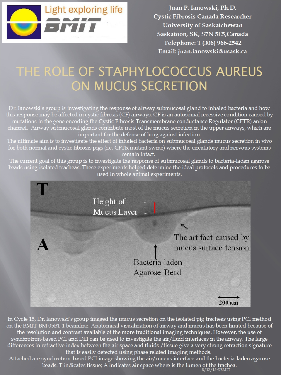 The Role of Staphylococcus Aureus on Mucus Secretion Image