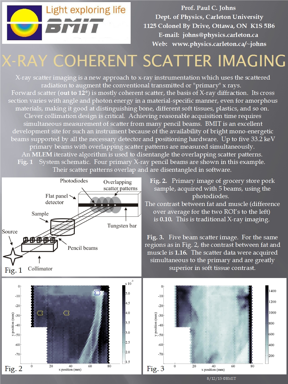 X-Ray Coherent Scatter Imaging Image