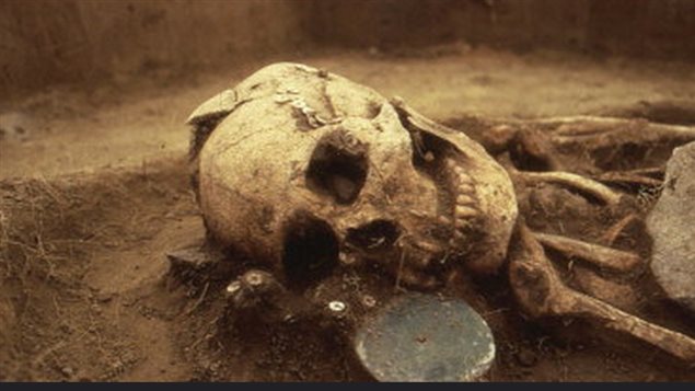 An ancient killing reveals genetic anomaly Image