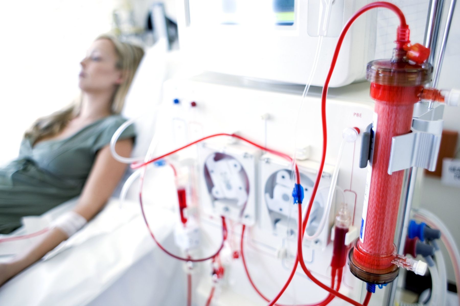 Improved treatment for patients with kidney failure Image