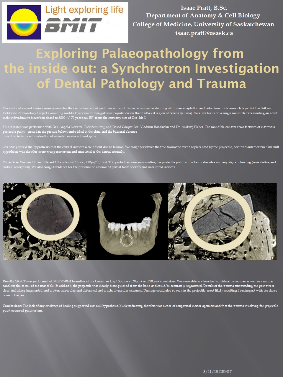 Exploring Paleopathology from the Inside Out: A Synchrotron Investigation of Dental Pathology and Trauma Image