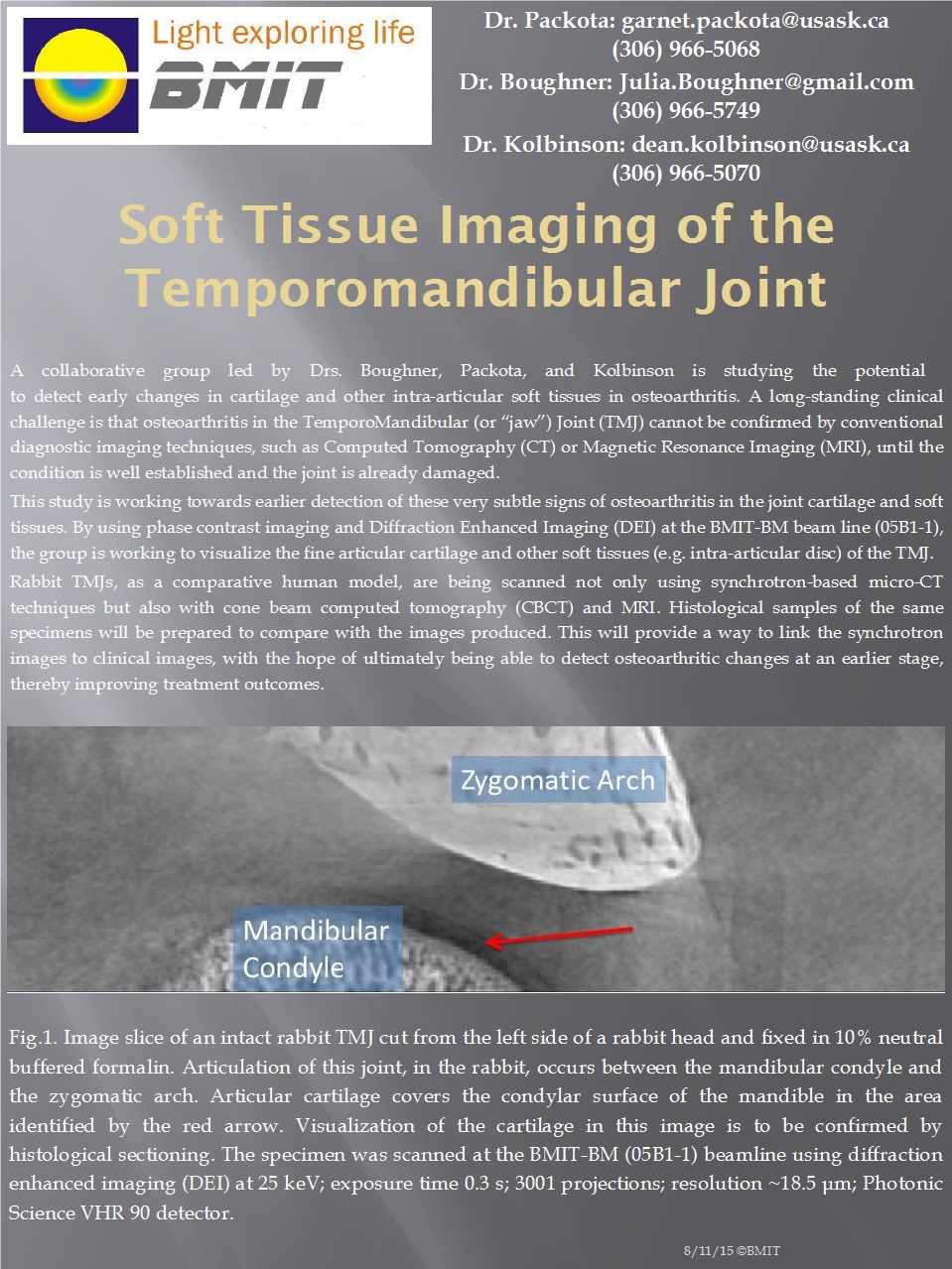 Soft Tissue Imaging Of the Temporomandibular Joint  Image