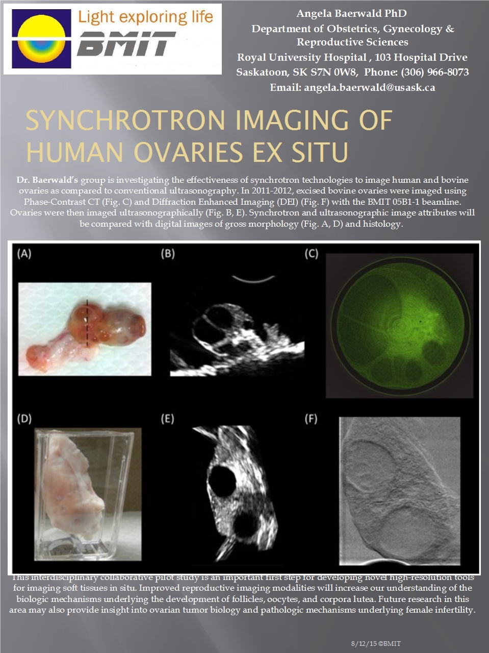 Synchrotron Imaging Of Human Ovaries ex Situ Image